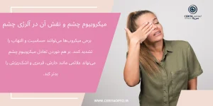 میکروبیوم چشم