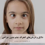 چرا بعضی‌ها چشم‌شان انحراف دارد؟ دلایل و درمان‌های انحراف چشم بدون جراحی