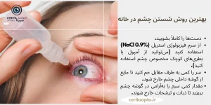 .بهترین روش شستن چشم در خانه