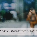 ضعیف شدن چشم: علائم، دلایل و بهترین روش‌های تشخیص