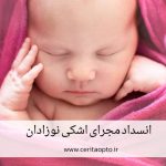 انسداد مجرای اشکی نوزادان؛ علائم، علت و درمان اشک‌ریزش مداوم چشم نوزاد